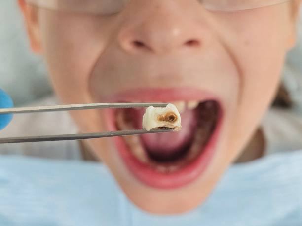 Best Emergency Treatment for Toothache in Northwest Harbor, NY